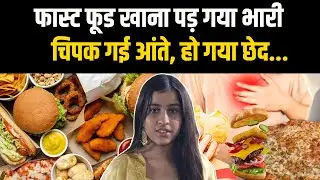 16 साल की लड़की को Fast Food खाना पड़ा भारी, चिपक गई आंते, हो गया छेद... | Bharat Express|