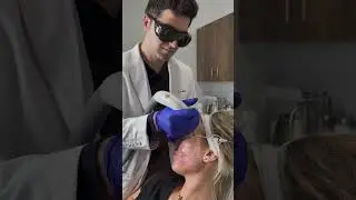 First of many treatments we will be doing this year ✨ #acne #acnetreatment #skincare #medspa