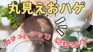 カチューシャを使ってウィッグ&薄毛をカバー☺︎