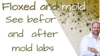 Floxed with mold exposure see before and after mold labs.  Ciprofloxacin toxicity treatments