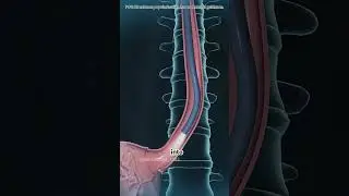 Endoscopic sleeve gastroplasty #drone #science #dentalprosthesis