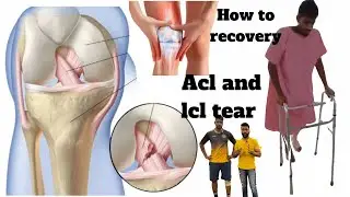 ACL and LCL injury after recovery exercise || knee pain relief || By Shivafitnessfreak ||