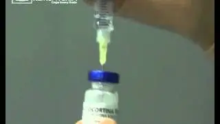 Mis 5 trucos para facoemulsificacion | Actocortina | Dr Rementeria