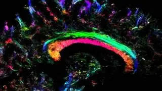 Diffusion MRI Brain Fibre Tractography: Track-density imaging (TDI)