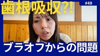 【歯列矯正日記#49】ブラオフして問題！！！まさかの歯根吸収？！