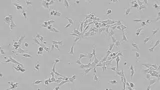 iPSC derived neural crest cell proliferation time-lapse | Using CytoSMART Lux2 live-cell imager