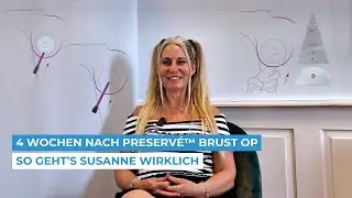 Erfahrungsbericht: Brust-OP mit Preservé™ – Susanne teilt ihr neues Lebensgefühl