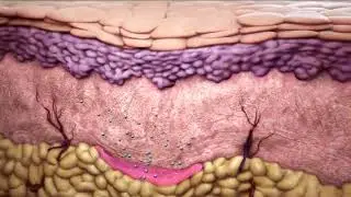 How Sculptra&reg; Works
