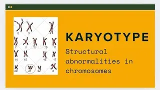 Normal karyotype/ Karyotype/ structural abnormalities in chromosomes. #karyotype #pathology 