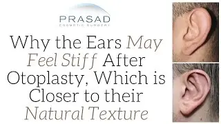 Why the Ears Feel Stiffer after Otoplasty, and Why this is Closer to their Natural Texture