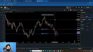 How I Manage My Trade💎 || DTS