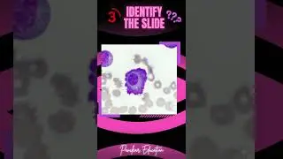 Identify The Slide! | Pathology Slides | #neetpg #fmge #inicet #pyq #pathology