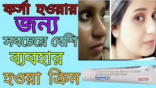 Panderm++ cream | Panderm plus cream bengali | Panderm ++ Bangla | Panderm plus use & side effects |