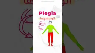 Let me explain different types of plegia! 👨&zwj;🦽 #shorts #medical #neurology