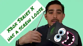 Xbox series x has a screw loose