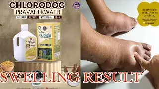 Awpl Swelling Fastet Result | Ratnagiri - Guhagar
