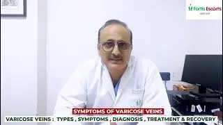 Varicose Veins Explained: Symptoms, Treatment & Recovery