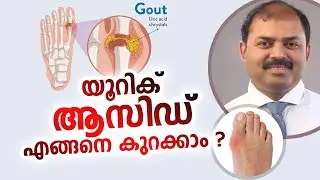 യൂറിക് ആസിഡ് എങ്ങനെ കുറക്കാം | Dr Anoof | Arogyam