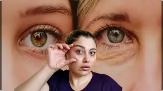 Rejuvenating the skin around the eyes and removing wrinkles around the eyes in ten days