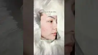 Anua Rice Ceramide-7 Barrier Serum⋆. 𐙚˚ #anua #kbeautyskincare #unboxing #viralvideo #viralreels