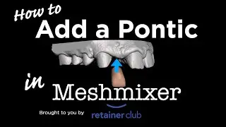Как добавить понтический зуб с помощью Meshmixer