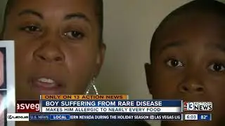 10-year-old Las Vegas boy allergic to nearly all foods