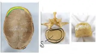 HISTOLOGY OF BONE,Osteoprogenitor,Osteoblasts,Osteocytes,Osteoclasts,PERIOSTEUM,ENDOSTEUM,Sharpey&rsquo;s