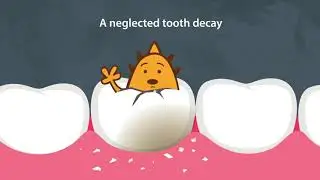 Philippine Dental Association: Growth Delay