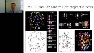 David Symer - High resolution genomic analysis reveals genetic impacts of human papillomavirus in hu