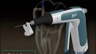E&Q Master Introductory Video