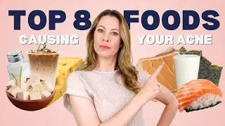 Stop Eating These 8 Surprising Foods If You Want Clear Skin