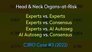 Head & Neck Organs-at-Risk: Comparison Summary Tables
