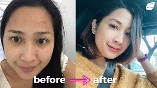 BEST SKINCARE PRODUCT FOR DRY SKIN | Kind Skincare Testimonial