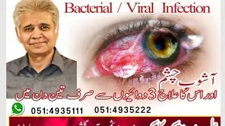 Eye Viral Infection and it's Treatment !! Dr Ali Muhammad