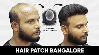 Low Dense hair patch | Hair patches for men| Hair Fixing in Bangalore | Call 9110221804 / 9742549827