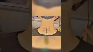 Best game about sucking - The Mosquito Gang! #indiegame #mosquitogang #steam #gameplayshorts  #games
