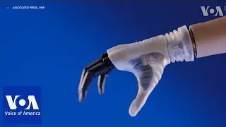 Italian researchers unveil lighter, cheaper robotic hand