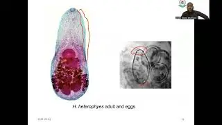 Intestinal Flukes LEM