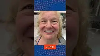 Before & After: The Power of Modern Dentistry!