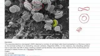 Lecture 16: Part 4 Blood rheology