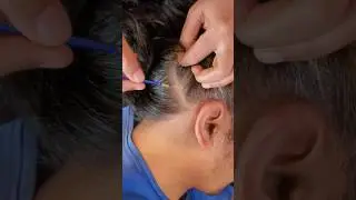 Scalp Check ASMR #hair #asmr #sleep #shorts #relax