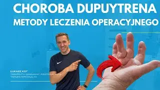 Choroba Dupuytrena. Co dalej, gdy fizjoterapia nie działa? Opcje operacyjne.