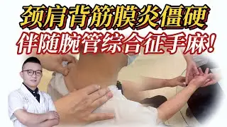 十年脖子肩背僵硬拉扯、手指麻木！颈肩背筋膜炎伴随腕管综合征！