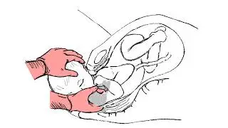 The Shoulder Shrug Maneuver
