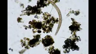 Long ciliate under a microscope