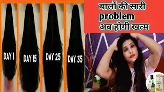 Nature sure Hair Growth oil 100% effective #lifestylenagma