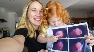 seeing baby in 4D for the FIRST time!!!