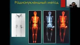 Диагностика заболеваний костей и суставов