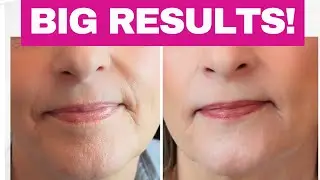 I stopped using the NIRA laser ~ Transforming my 60+ skin in 4 months!