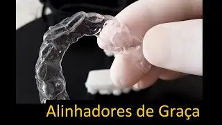 Alinhador Ortodôntico Invisível Digital - Programa Meshmixer